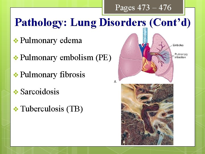 Pages 473 – 476 Pathology: Lung Disorders (Cont’d) v Pulmonary edema v Pulmonary embolism
