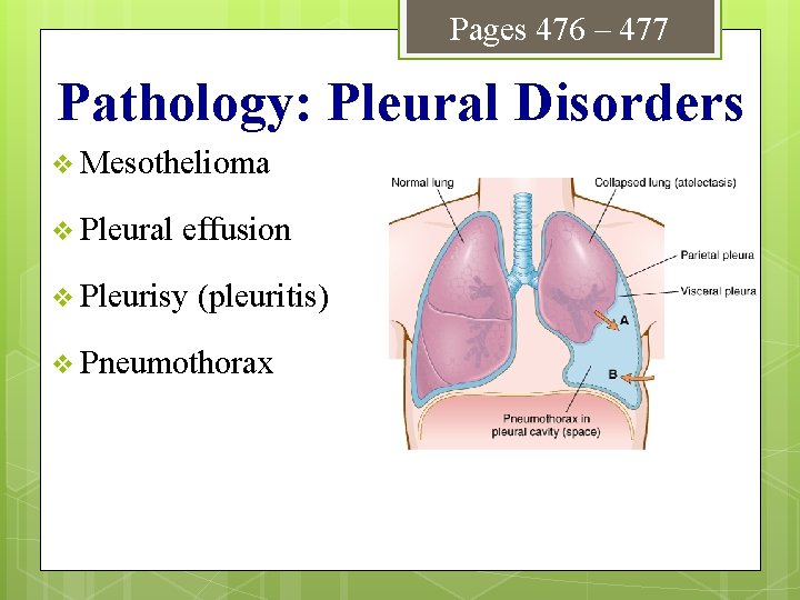 Pages 476 – 477 Pathology: Pleural Disorders v Mesothelioma v Pleural effusion v Pleurisy