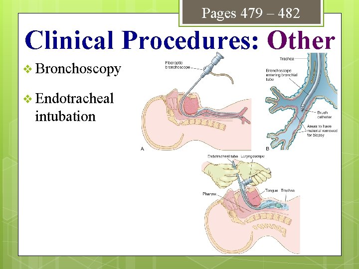 Pages 479 – 482 Clinical Procedures: Other v Bronchoscopy v Endotracheal intubation 