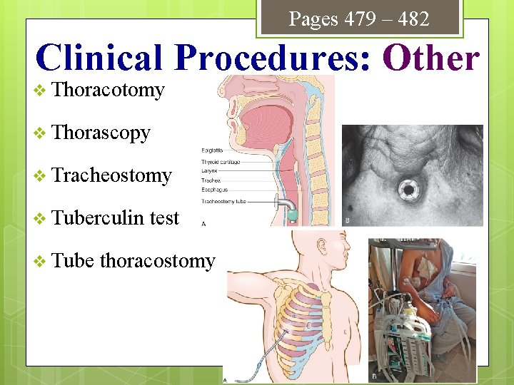 Pages 479 – 482 Clinical Procedures: Other v Thoracotomy v Thorascopy v Tracheostomy v