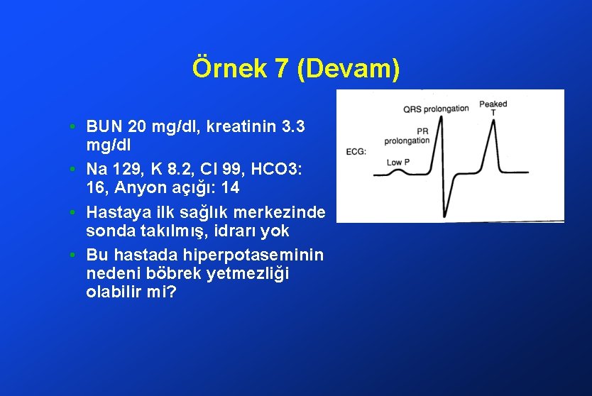 Örnek 7 (Devam) • BUN 20 mg/dl, kreatinin 3. 3 mg/dl • Na 129,