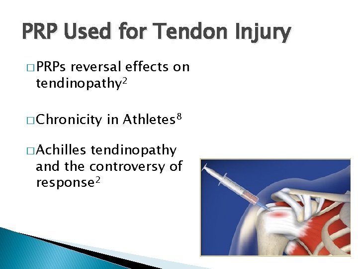 PRP Used for Tendon Injury � PRPs reversal effects on tendinopathy 2 � Chronicity