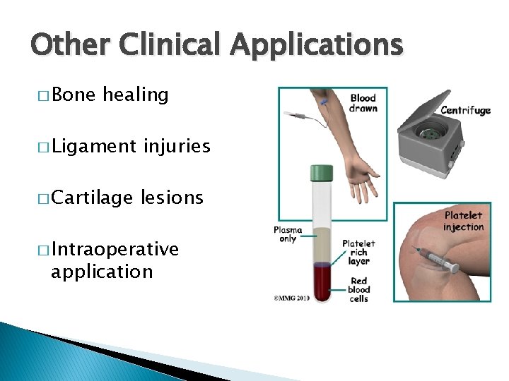 Other Clinical Applications � Bone healing � Ligament injuries � Cartilage lesions � Intraoperative
