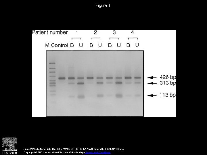 Figure 1 Kidney International 2001 591236 -1243 DOI: (10. 1046/j. 1523 -1755. 2001. 0590041236.