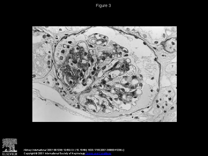 Figure 3 Kidney International 2001 591236 -1243 DOI: (10. 1046/j. 1523 -1755. 2001. 0590041236.