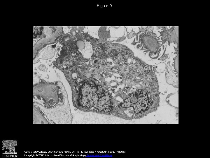 Figure 5 Kidney International 2001 591236 -1243 DOI: (10. 1046/j. 1523 -1755. 2001. 0590041236.