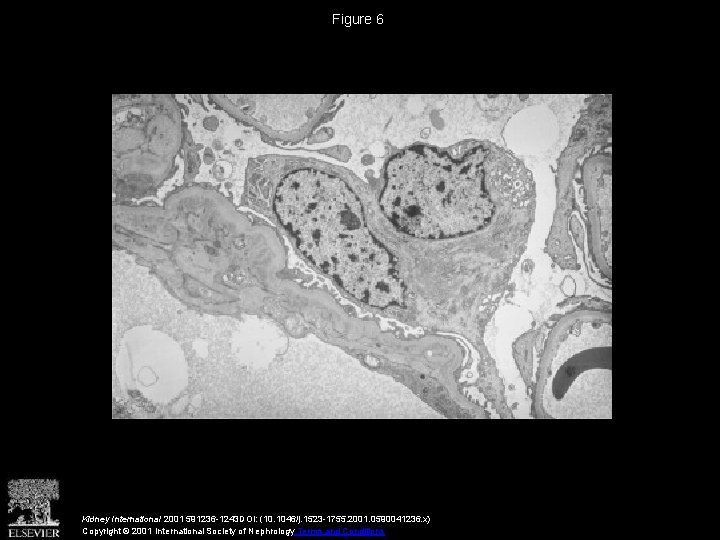 Figure 6 Kidney International 2001 591236 -1243 DOI: (10. 1046/j. 1523 -1755. 2001. 0590041236.