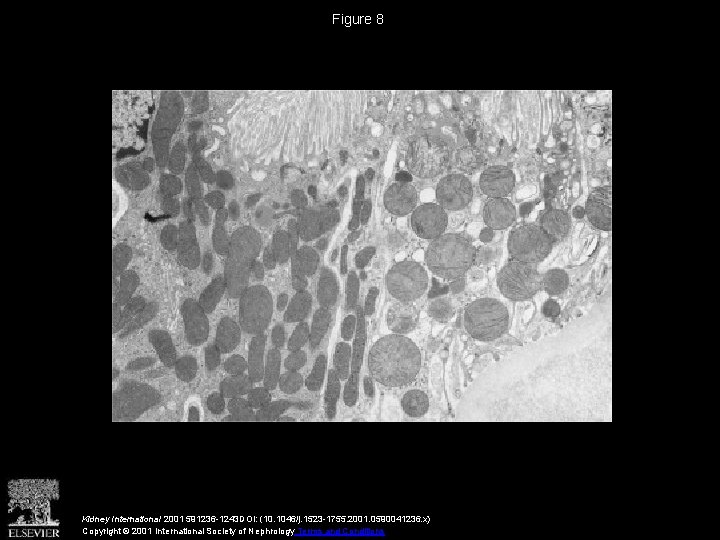 Figure 8 Kidney International 2001 591236 -1243 DOI: (10. 1046/j. 1523 -1755. 2001. 0590041236.