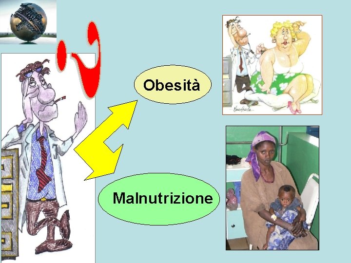 Obesità Malnutrizione 