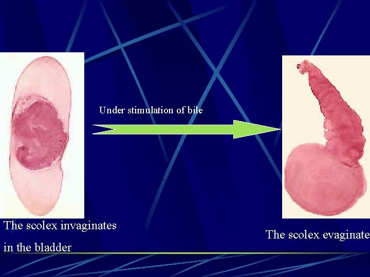 Under stimulation of bile The scolex invaginates in the bladder The scolex evaginates 