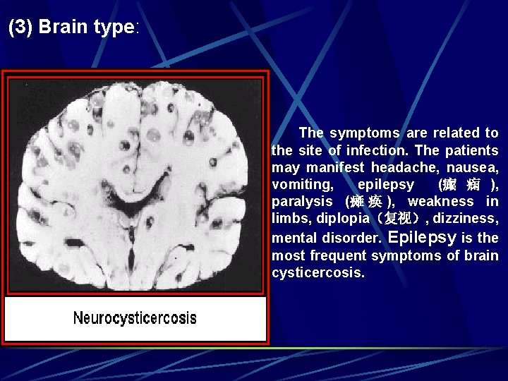 (3) Brain type: The symptoms are related to the site of infection. The patients