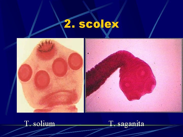 2. scolex T. solium T. saganita 