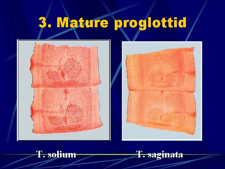 3. Mature proglottid T. solium T. saginata 