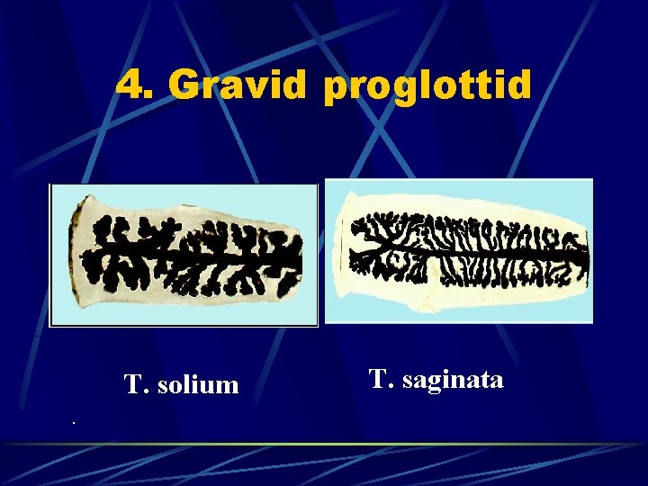 4. Gravid proglottid T. solium. T. saginata 
