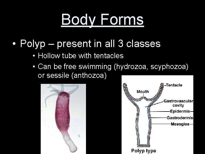 Body Forms • Polyp – present in all 3 classes • Hollow tube with