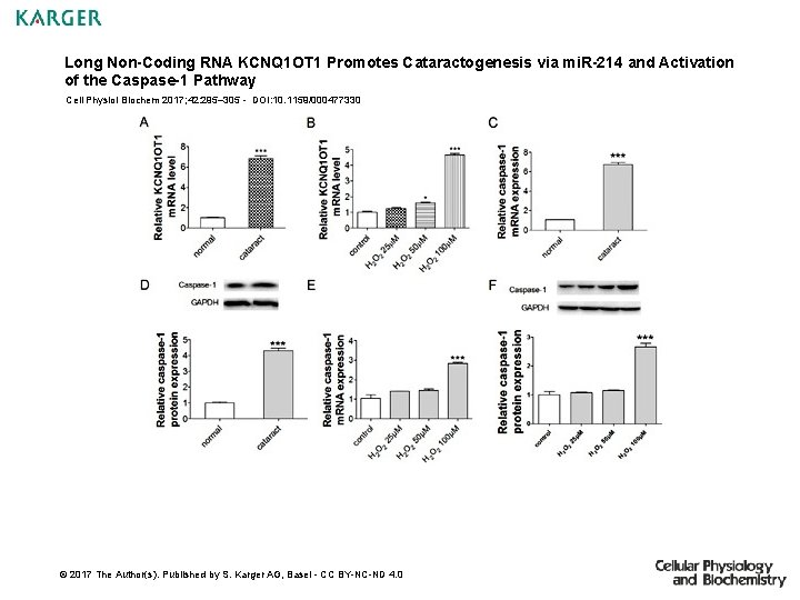 Long Non-Coding RNA KCNQ 1 OT 1 Promotes Cataractogenesis via mi. R-214 and Activation