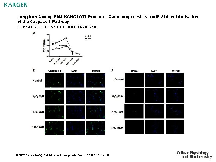 Long Non-Coding RNA KCNQ 1 OT 1 Promotes Cataractogenesis via mi. R-214 and Activation