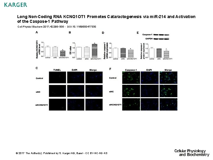 Long Non-Coding RNA KCNQ 1 OT 1 Promotes Cataractogenesis via mi. R-214 and Activation