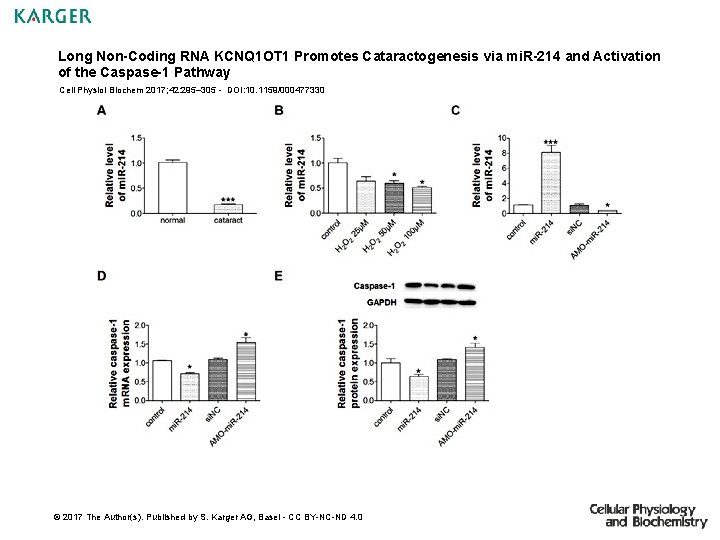 Long Non-Coding RNA KCNQ 1 OT 1 Promotes Cataractogenesis via mi. R-214 and Activation