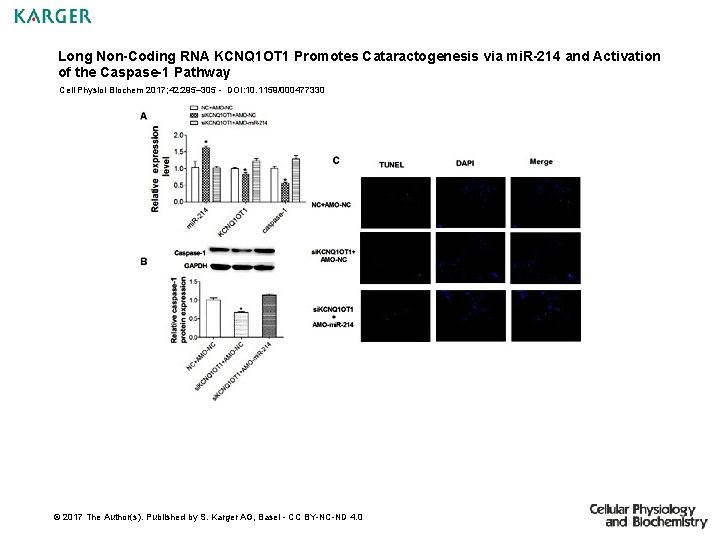 Long Non-Coding RNA KCNQ 1 OT 1 Promotes Cataractogenesis via mi. R-214 and Activation