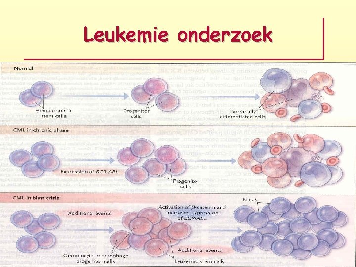 Leukemie onderzoek 