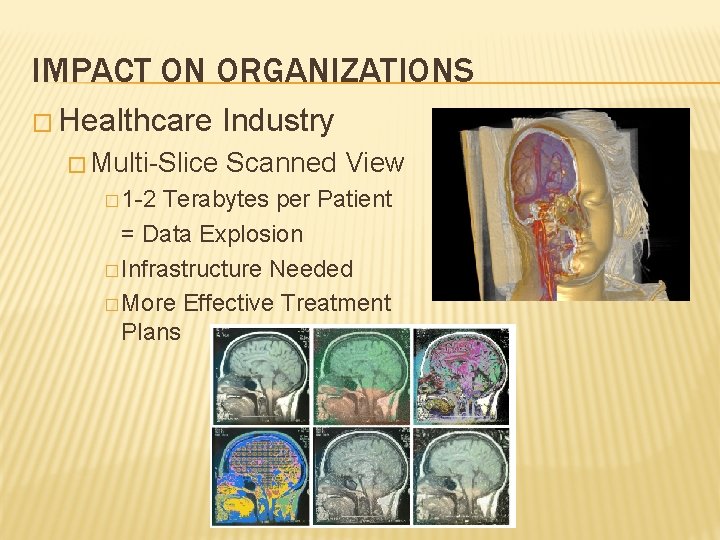 IMPACT ON ORGANIZATIONS � Healthcare � Multi-Slice � 1 -2 Industry Scanned View Terabytes