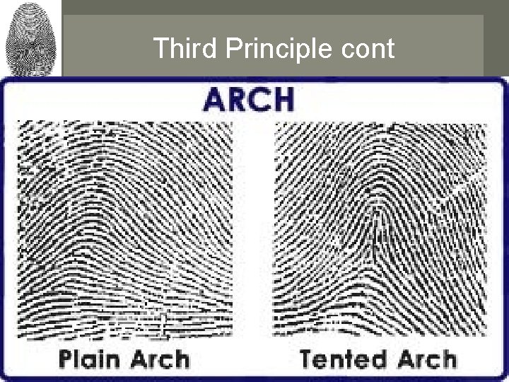 Third Principle cont • Arches 5% of the worlds population displays this type of Third Principle cont • Arches 5% of the worlds population displays this type of