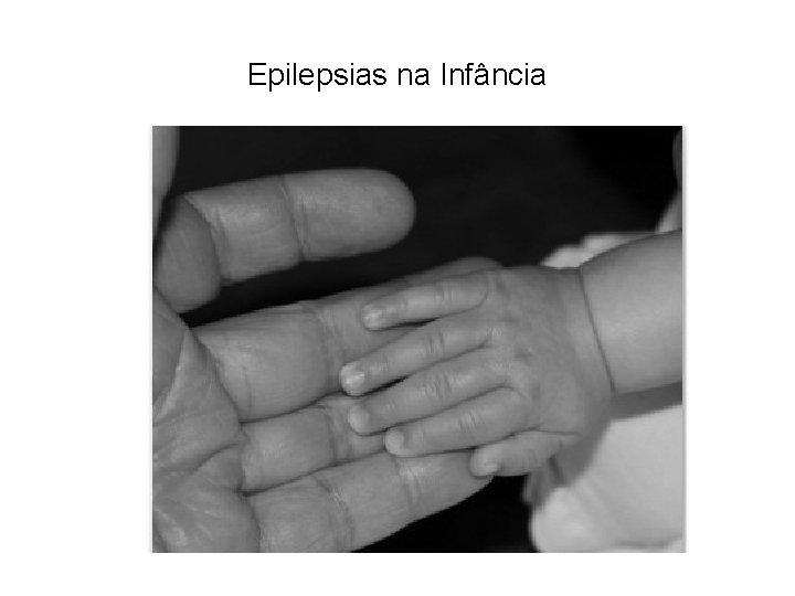 Epilepsias na Infância 