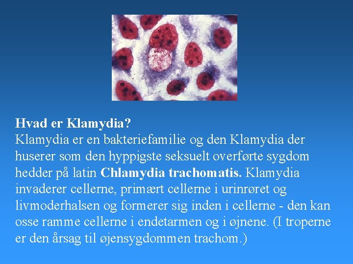 Hvad er Klamydia? Klamydia er en bakteriefamilie og den Klamydia der huserer som den Hvad er Klamydia? Klamydia er en bakteriefamilie og den Klamydia der huserer som den