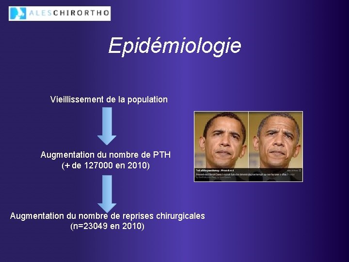 Epidémiologie Vieillissement de la population Augmentation du nombre de PTH (+ de 127000 en