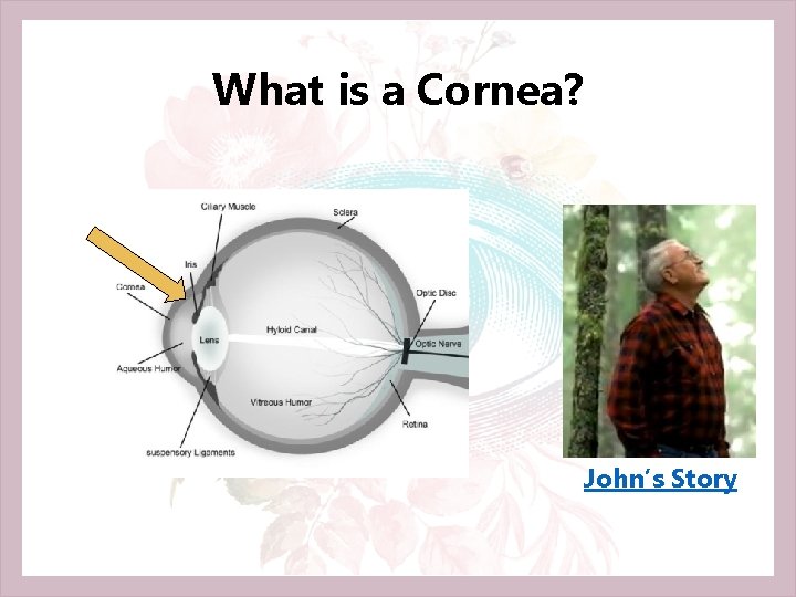 What is a Cornea? John’s Story 