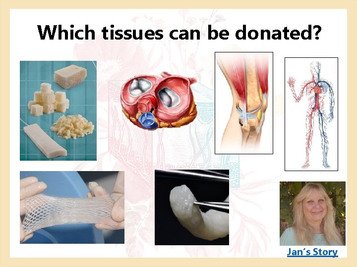 Which tissues can be donated? Jan’s Story 