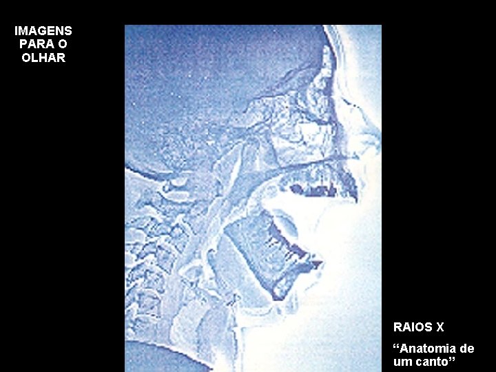 IMAGENS PARA O OLHAR RAIOS X “Anatomia de um canto” 