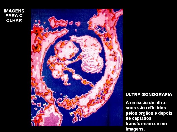 IMAGENS PARA O OLHAR ULTRA-SONOGRAFIA A emissão de ultrasons são refletidos pelos órgãos e