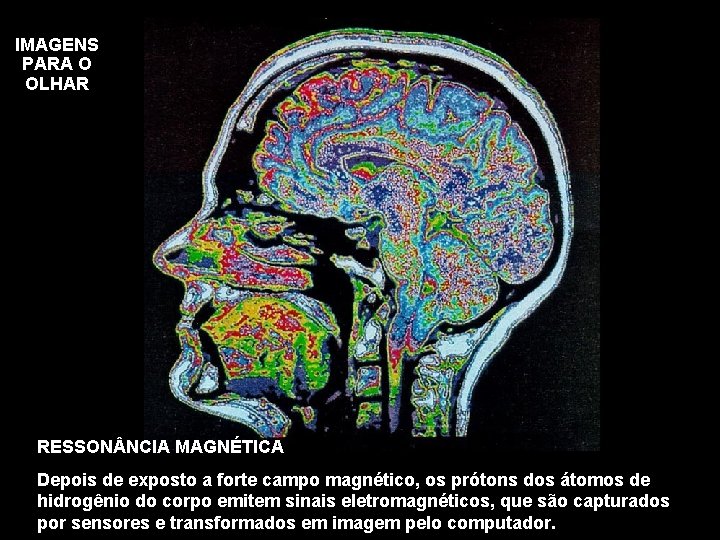 IMAGENS PARA O OLHAR RESSON NCIA MAGNÉTICA Depois de exposto a forte campo magnético,