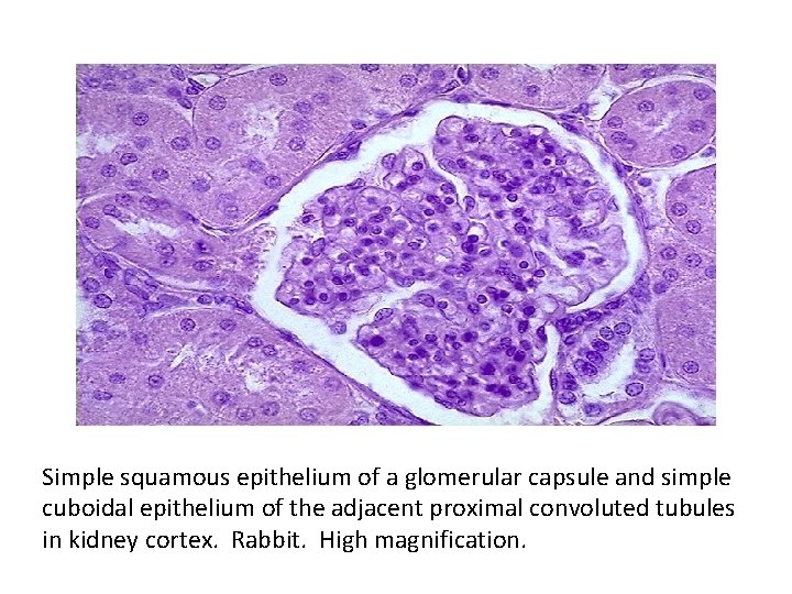 Simple squamous epithelium of a glomerular capsule and simple cuboidal epithelium of the adjacent