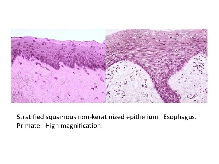 Stratified squamous non-keratinized epithelium. Esophagus. Primate. High magnification. 