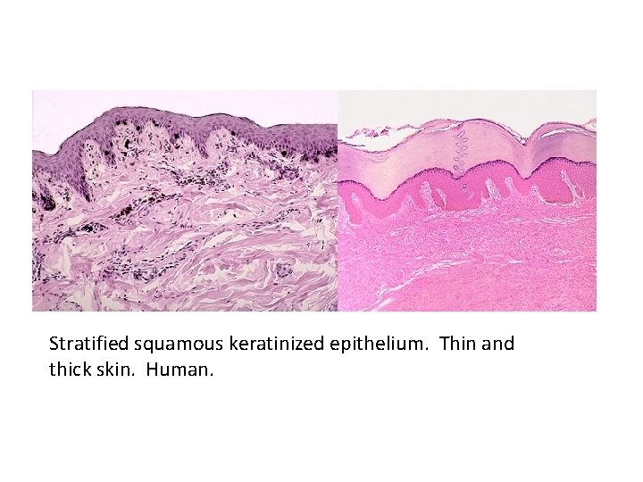 Stratified squamous keratinized epithelium. Thin and thick skin. Human. 