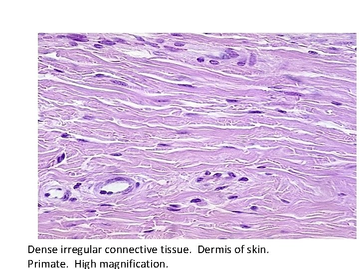 Dense irregular connective tissue. Dermis of skin. Primate. High magnification. 
