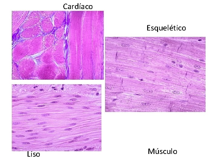 Cardíaco Esquelético Liso Músculo 