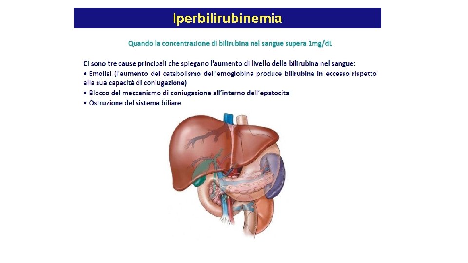Iperbilirubinemia Iperbilirubinemia