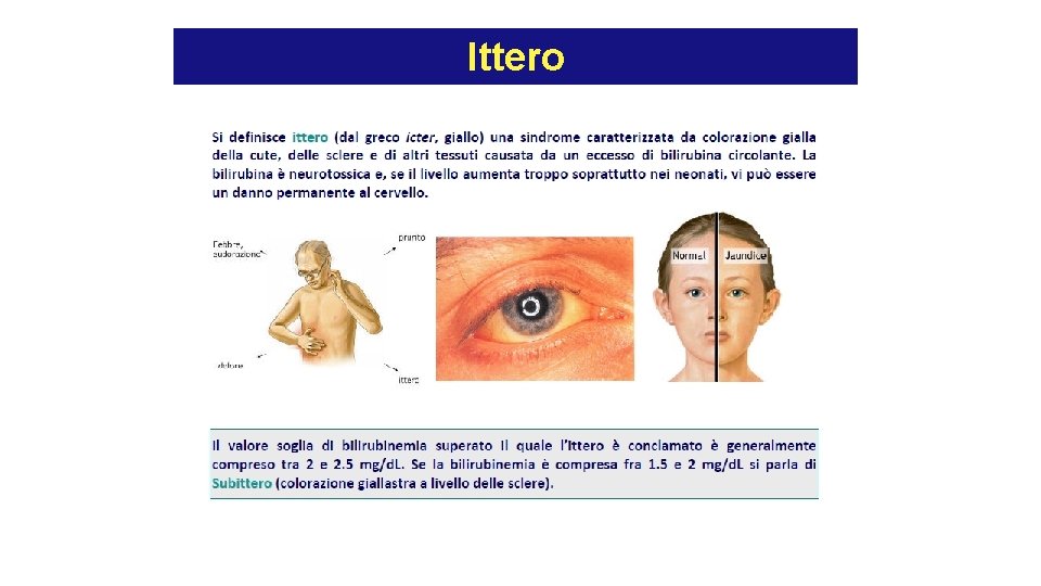 Ittero Ittero