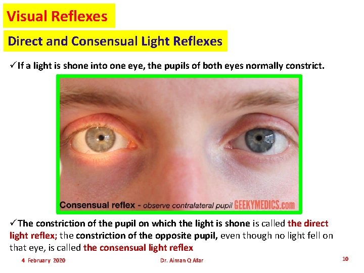 Visual Reflexes Direct and Consensual Light Reflexes üIf a light is shone into one