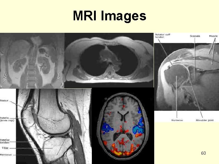 MRI Images 60 