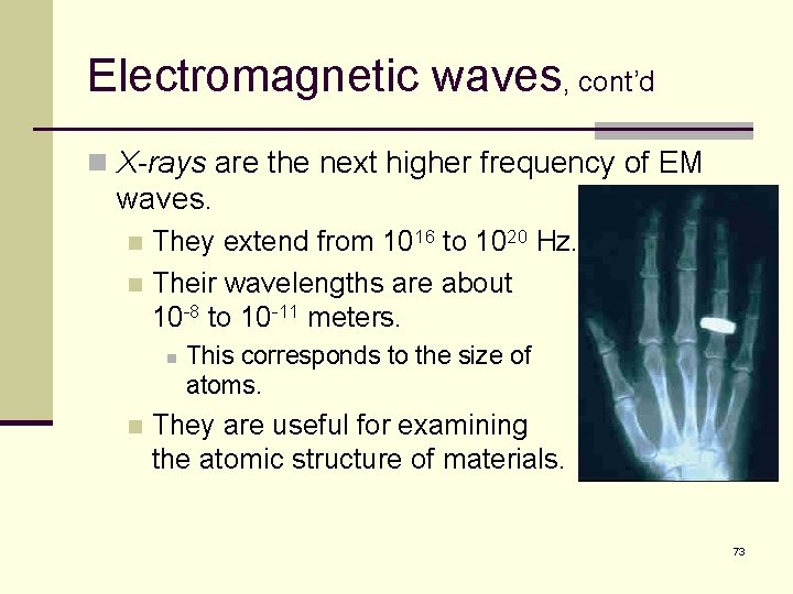 Electromagnetic waves, cont’d n X-rays are the next higher frequency of EM waves. They
