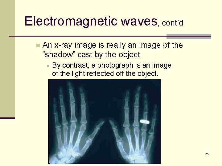 Electromagnetic waves, cont’d n An x-ray image is really an image of the “shadow”