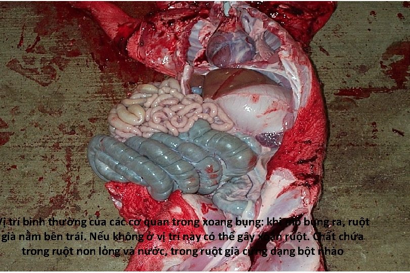 Vị trí bình thường của các cơ quan trong xoang bụng: khi mổ bụng