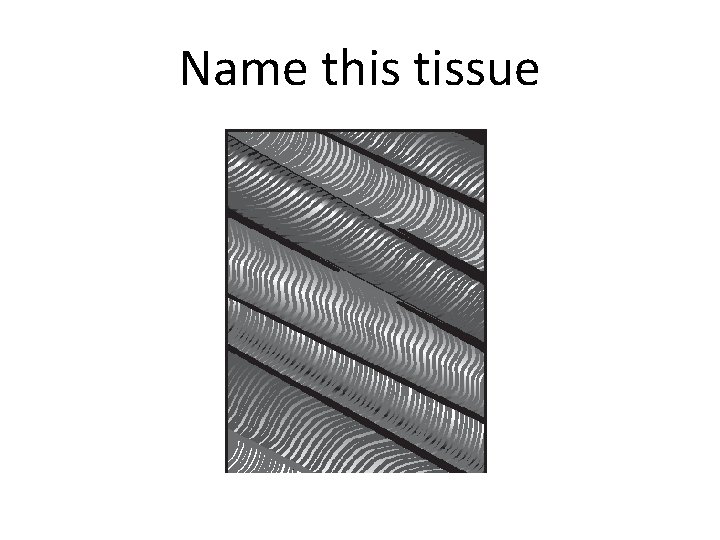 Name this tissue 