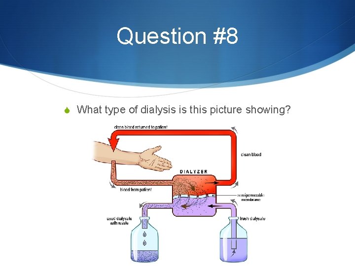 Question #8 S What type of dialysis is this picture showing? 