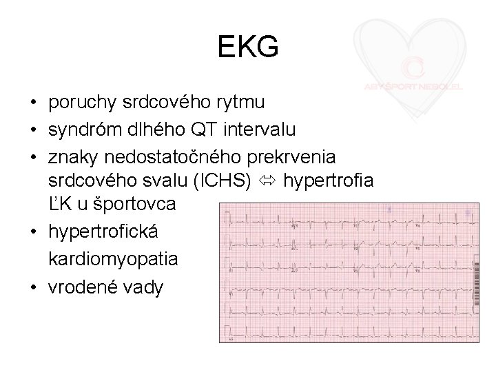 EKG • poruchy srdcového rytmu • syndróm dlhého QT intervalu • znaky nedostatočného prekrvenia